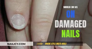 Damaged Nails and Gels: What's the Verdict?