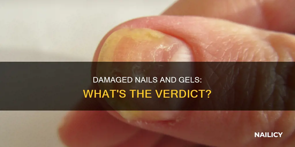 should i do gel on damaged nails