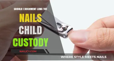 Long Toenails: Documenting Child Custody Evidence