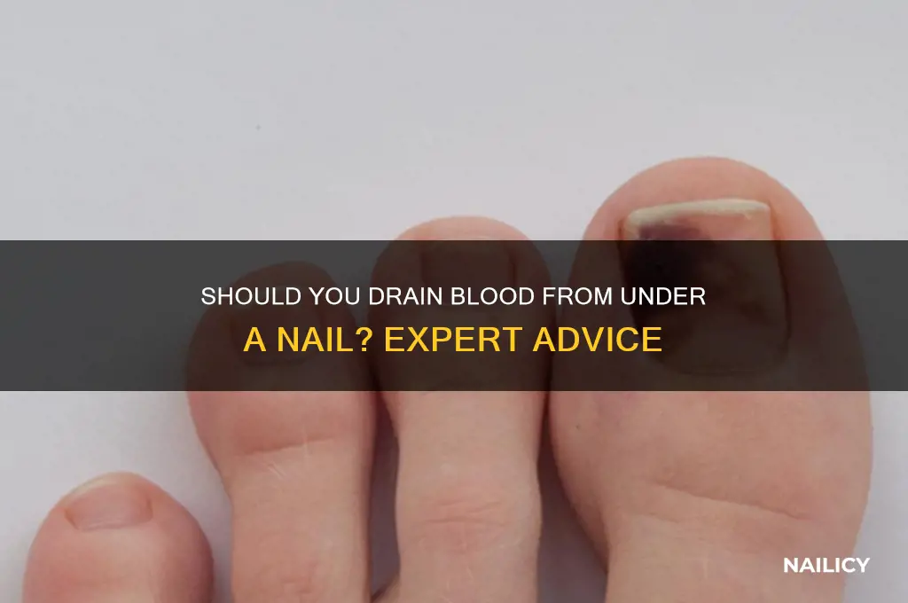 should i drain blood from under nail