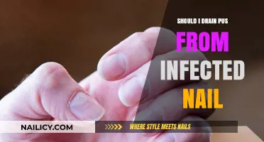 Should You Drain Pus from an Infected Nail? Expert Advice