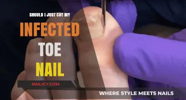 Toe Nail Infection: Cut or Not to Cut?