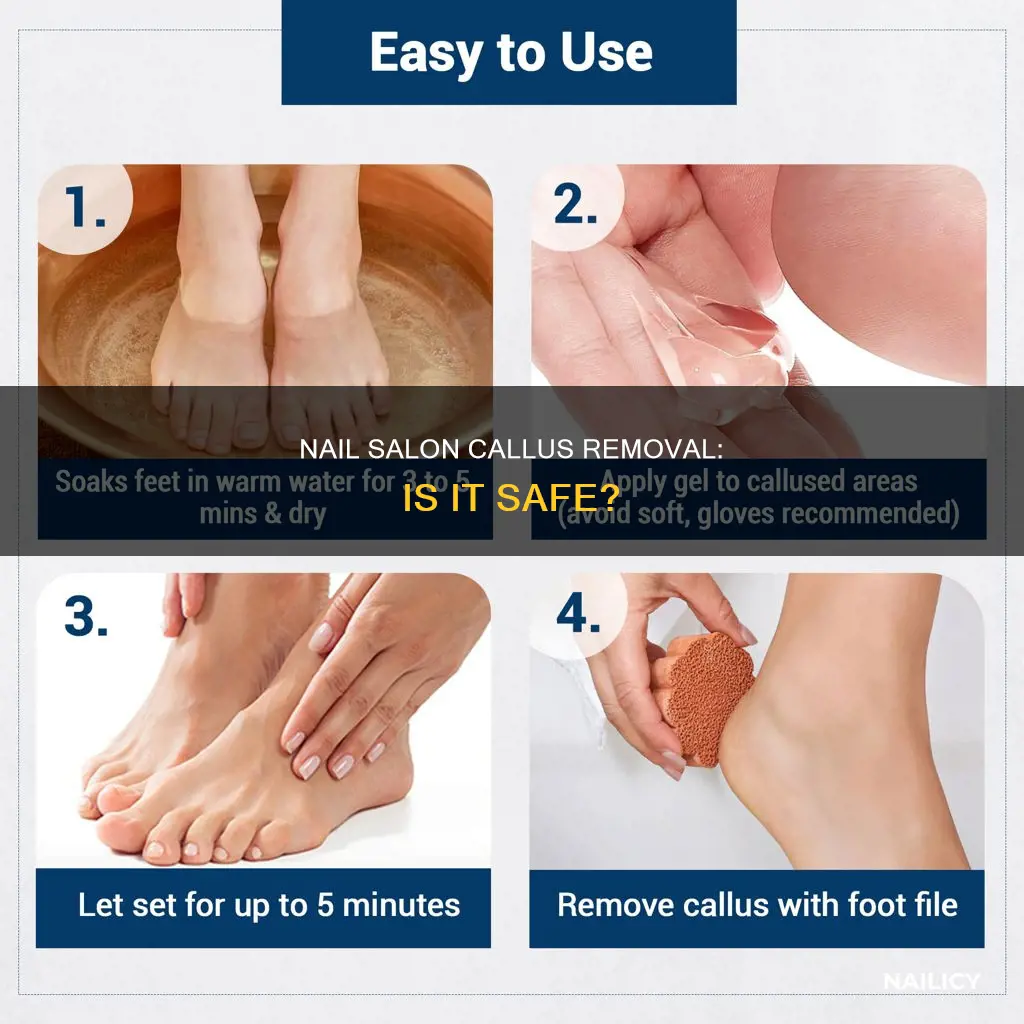 should i let a nail salon remove calluses