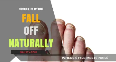 Should You Let a Nail Fall Off Naturally? Expert Advice