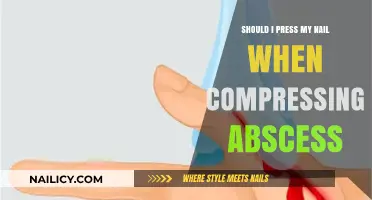 Should You Press Your Nail When Compressing an Abscess? Expert Advice