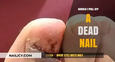Should You Remove a Dead Nail? Risks, Tips, and Healing Advice