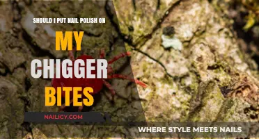 Nail Polish on Chigger Bites: Effective Remedy or Harmful Myth?