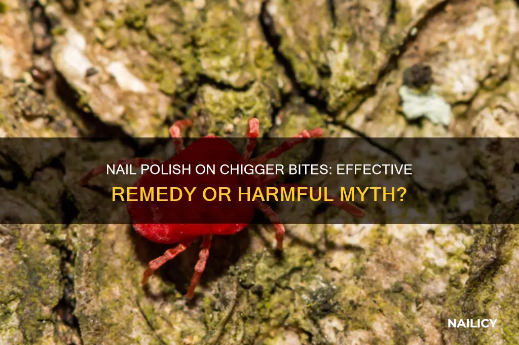 should i put nail polish on my chigger bites