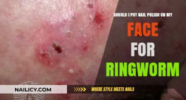 Nail Polish for Ringworm: Safe or Risky Facial Treatment?
