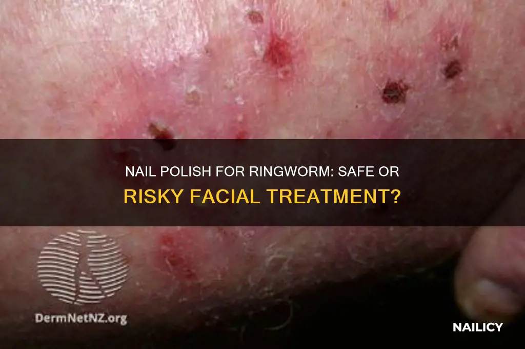 should i put nail polish on my face for ringworm