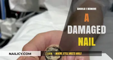 Damaged Nail Removal: When and How?