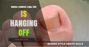 Don't Pull Off That Hanging Nail!