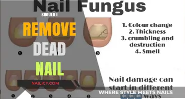 Don't Remove Dead Nails: Here's Why