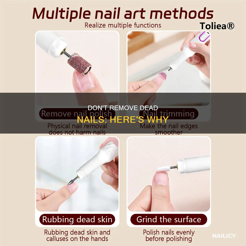 should i remove dead nail