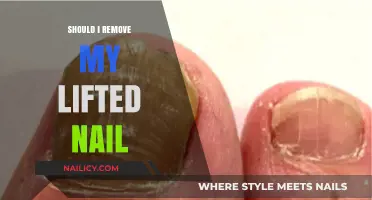 Don't Remove Lifted Nails: Here's Why
