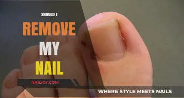 Removing Nails: Is it Worth the Risk?