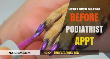 Podiatrist Appointment: Keep or Remove Nail Polish?