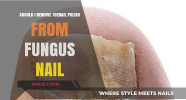 Toenail Polish: Keep or Remove with Fungus?