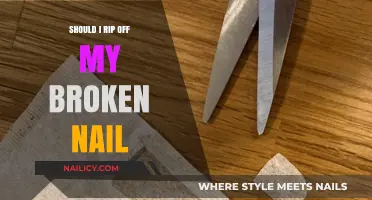 Broken Nail Dilemma: To Rip or Not to Rip?