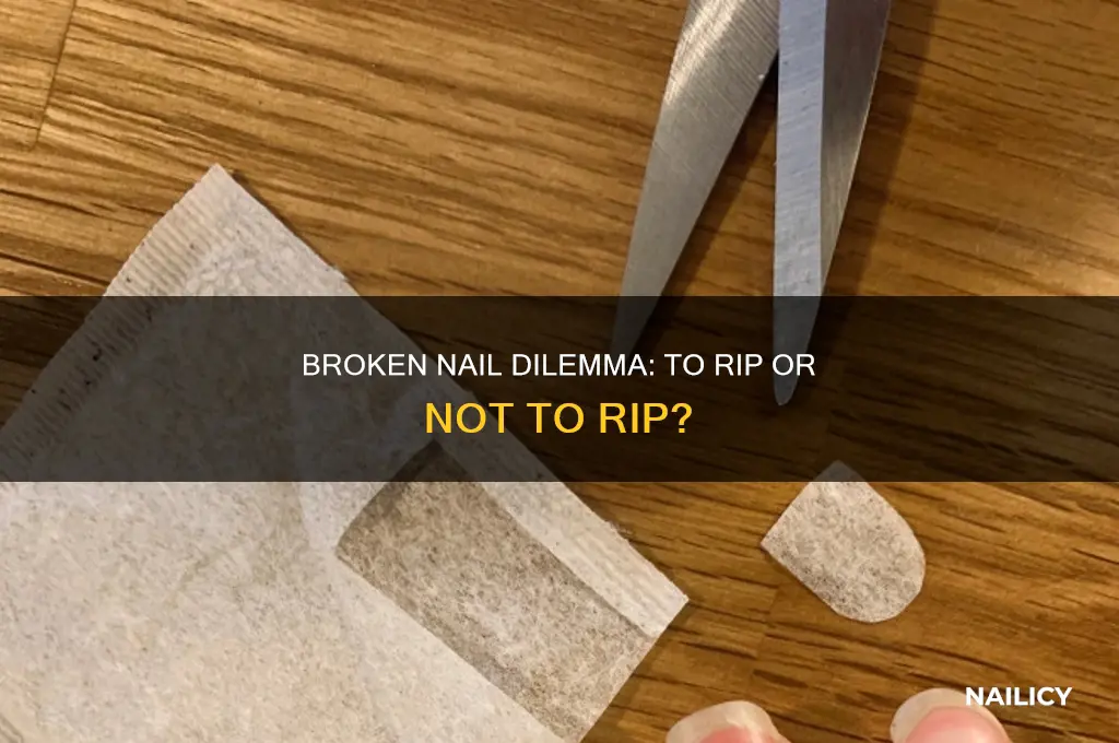 should i rip off my broken nail
