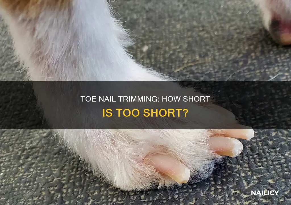 should i trim my toe nail all