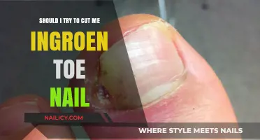 Ingrown Toenail: To Cut or Not to Cut?