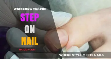 Should Mark Go Away After Stepping on a Nail?