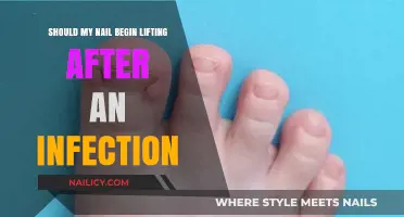 Nail Lifting Post-Infection: Causes, Concerns, and Recovery Tips