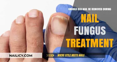 Nail Fungus Treatment: Remove Old Nails or Not?