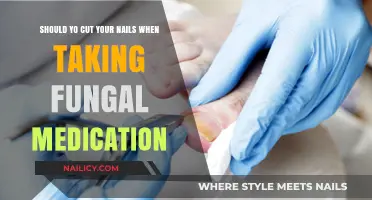 Nail Care: Cutting Nails While on Fungal Medication