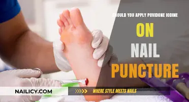 Nail Puncture Wound Care: Povidone Iodine Application Pros and Cons