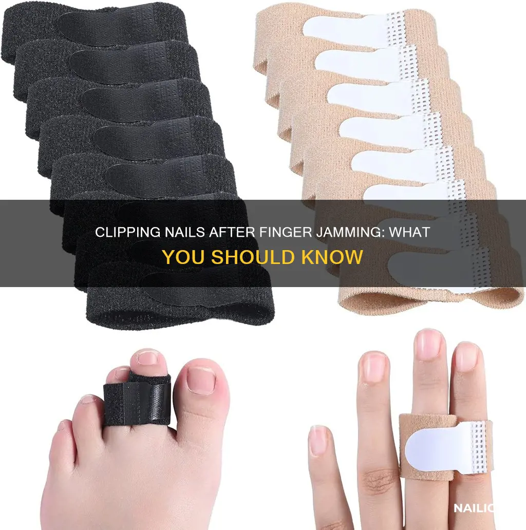should you clip nails if the finger is jammed