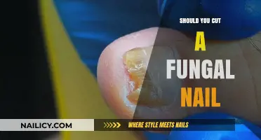 Cutting Fungal Nails: What You Need to Know
