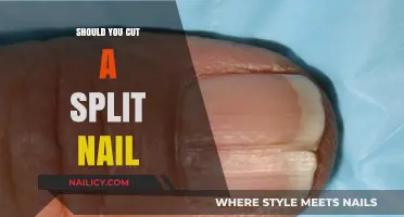 How to Treat Split Nails: Cut or Not?