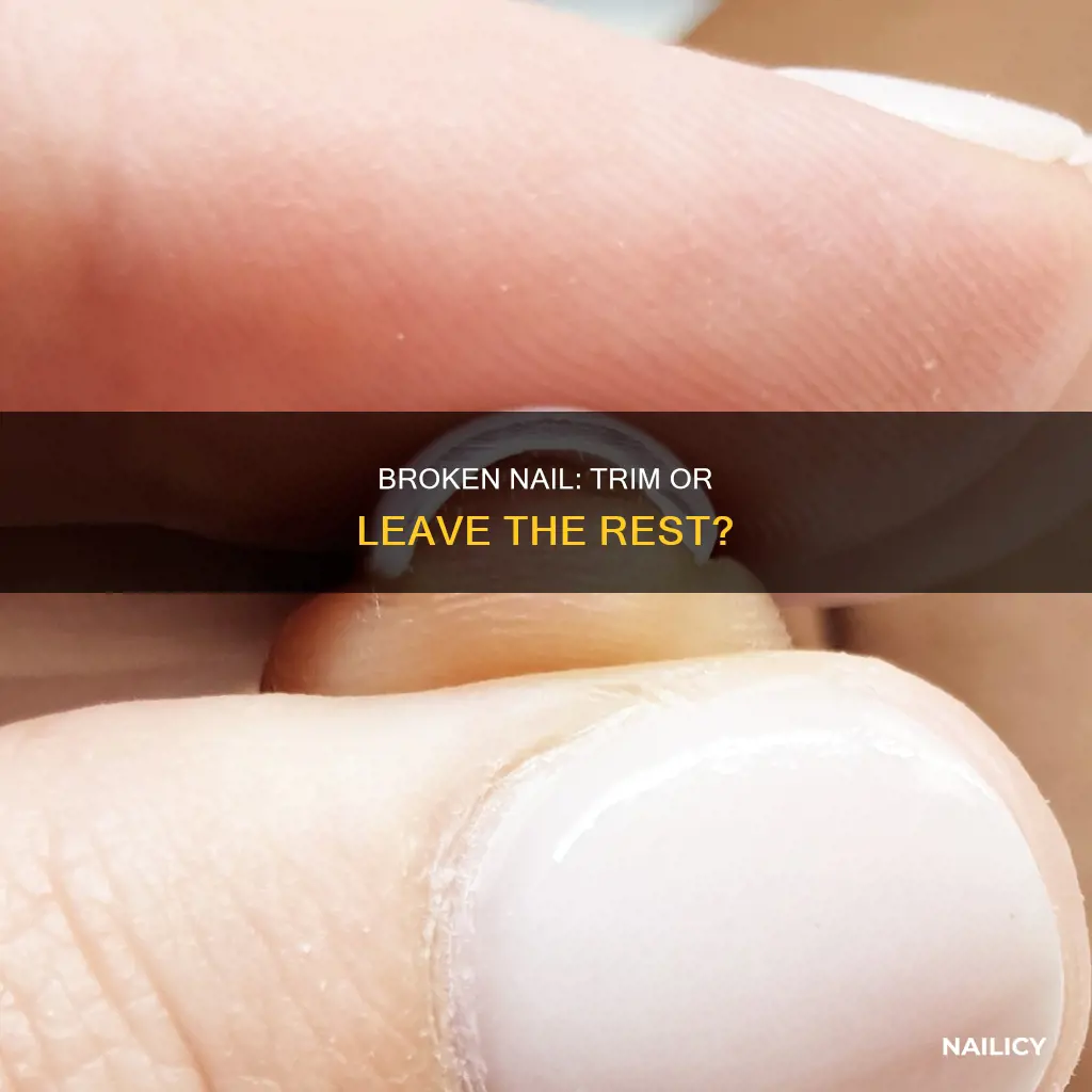should you cut all your nails if one breaks