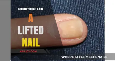 How to Treat a Lifted Nail: To Cut or Not?