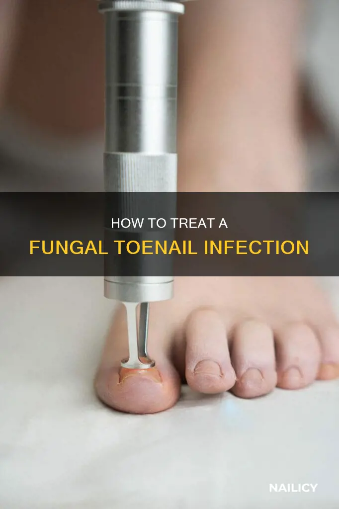should you cut off dead fungus toe nail