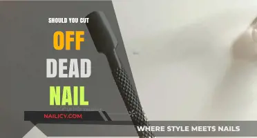 Trimming Dead Nails: What You Need to Know