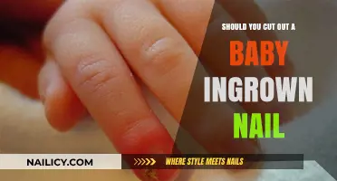 Baby's Ingrown Nail: To Cut or Not to Cut?