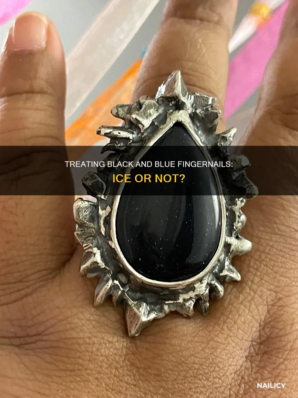 should you ice a black and blue finger nail