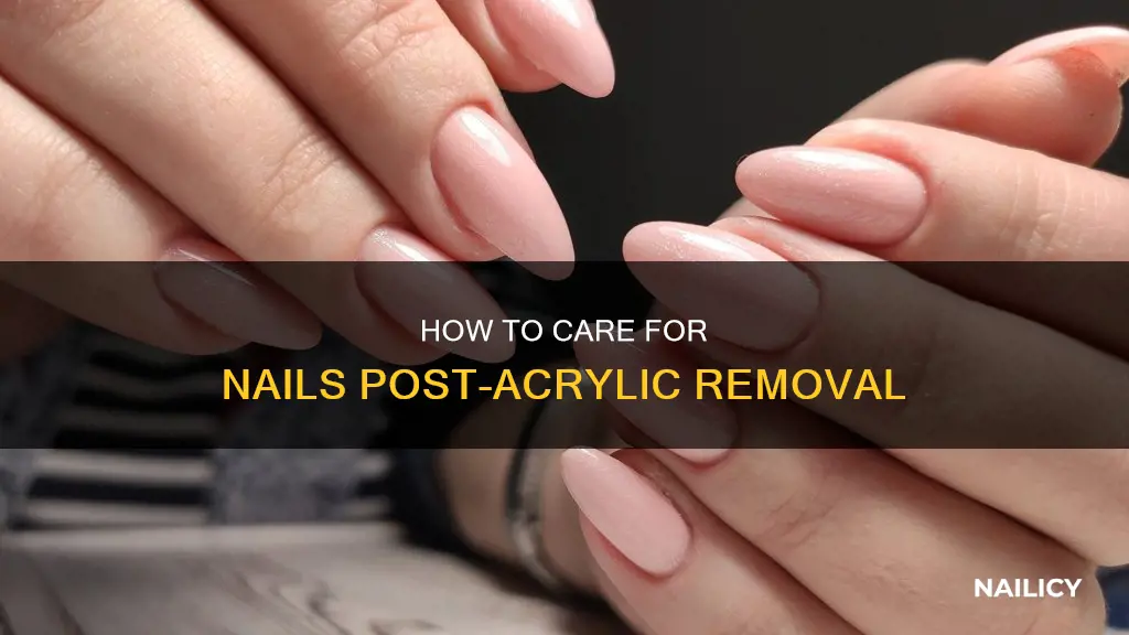 should you paint your nails after removing acrylics