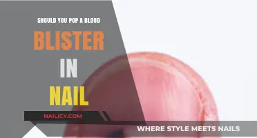 Should You Pop a Blood Blister Under Your Nail? Risks and Care Tips