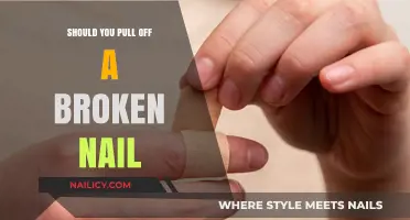 Broken Nail Emergency: To Pull or Not to Pull?