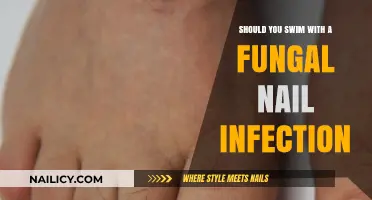 Swimming with Fungal Nail Infections: Risks, Precautions, and Best Practices