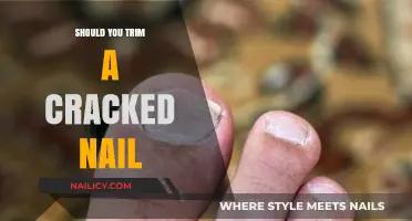 How to Treat a Cracked Nail: Trim or Not?