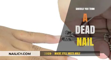 Trimming Dead Nails: What You Need to Know