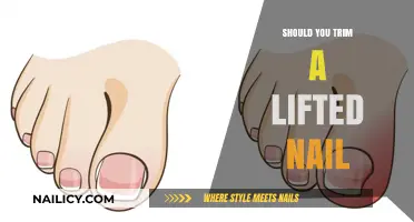 How to Treat and Trim a Lifted Nail