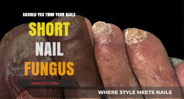 Trim Nails Short to Prevent Nail Fungus?