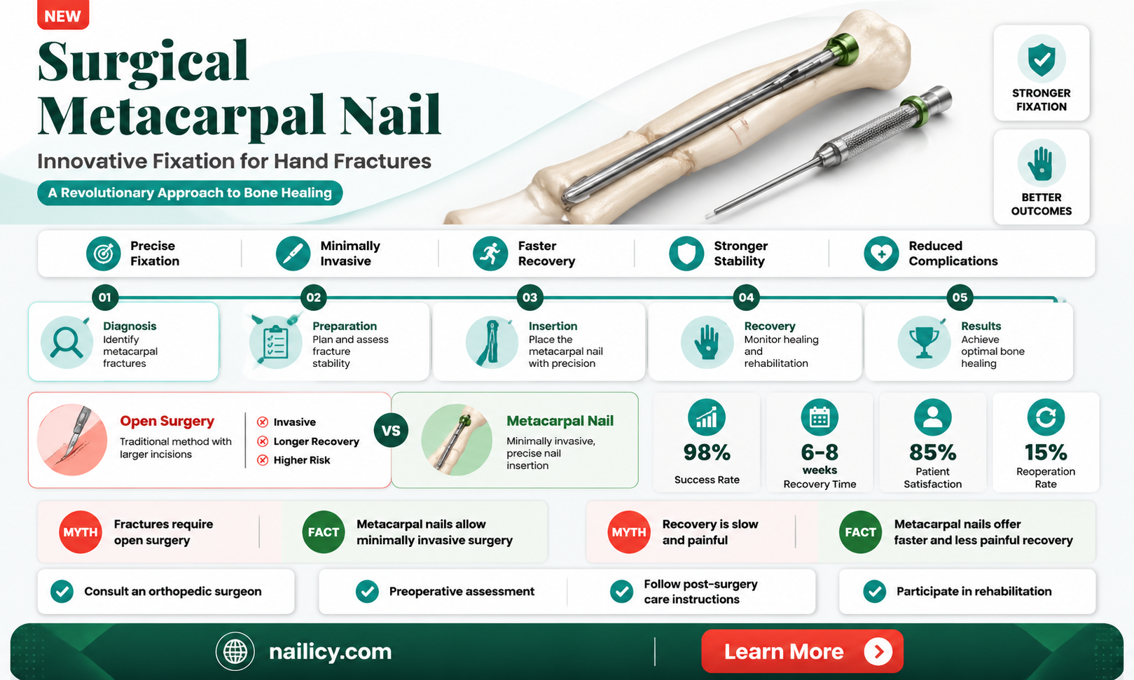 am surgical metacarpal nail