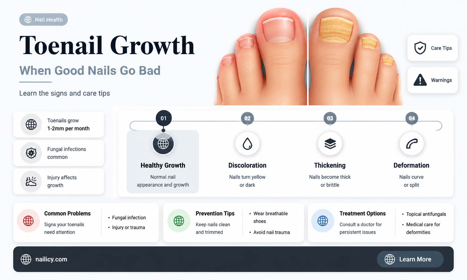 are in grow toe nails bad